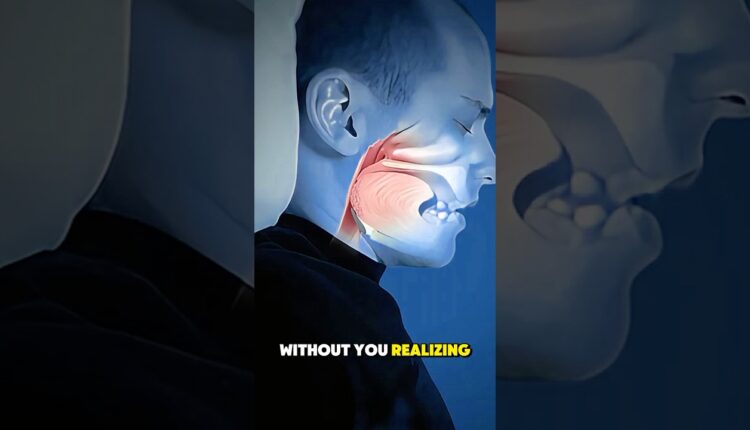 Sleep Apnea procedure-3D Animation – MindNell